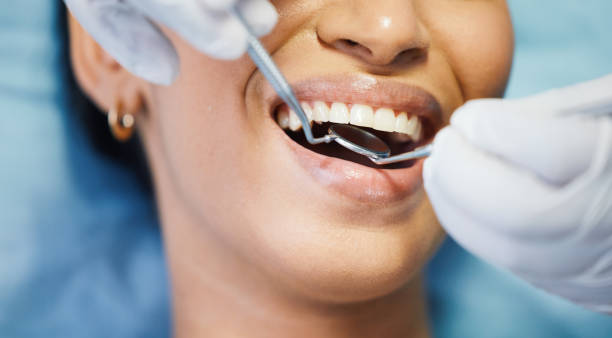 Best Dentist for Tooth Abscess  in Alamae, NC